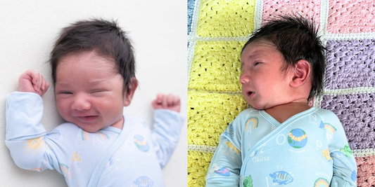 newborn baby boy with torticollis looking to his right side